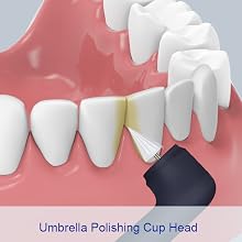 Tooth Polisher