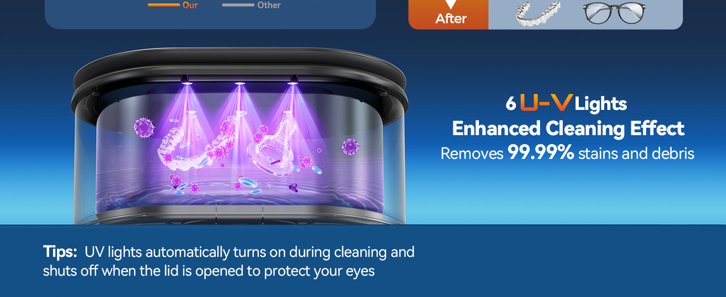 ultrasonic retainer cleaner