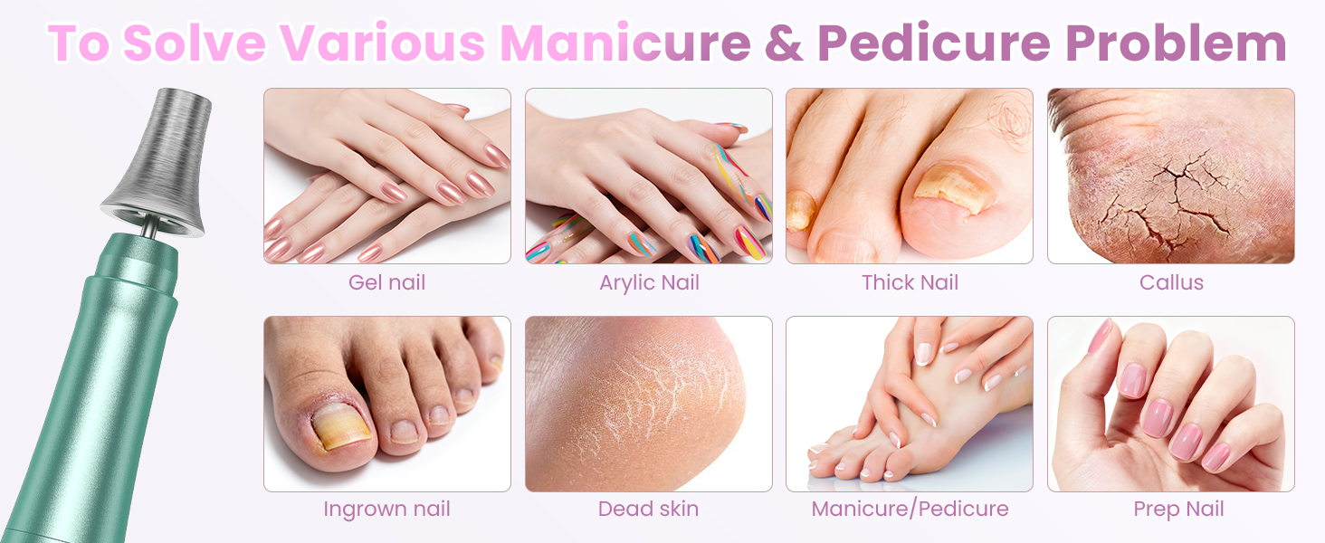 pedicure problem
