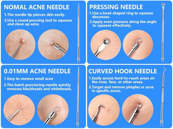 blackhead remover tools