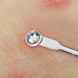 Beaute Galleria Eyehole Blackhead Remover Pimple Extractor for Acne Comedone Blemish Removal Tool