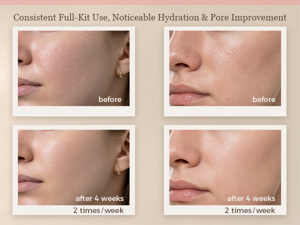 facial steamer