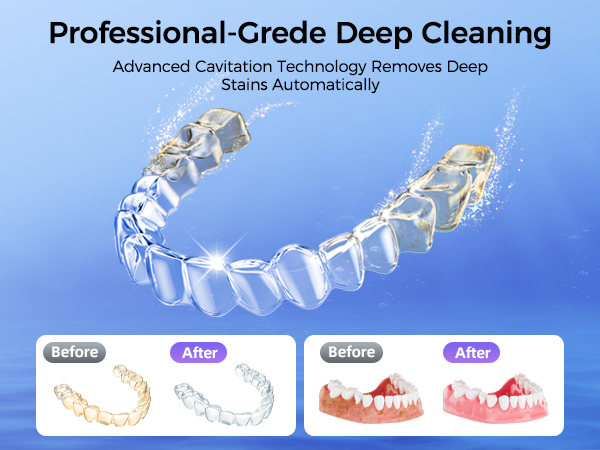 dental pod ultrasonic cleaner for retainers