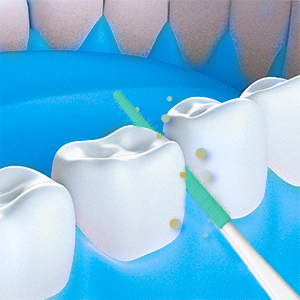 narrow dental picks