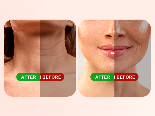 light therapy for face