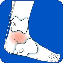 Omron TENS Pads
