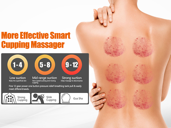 cupping set
