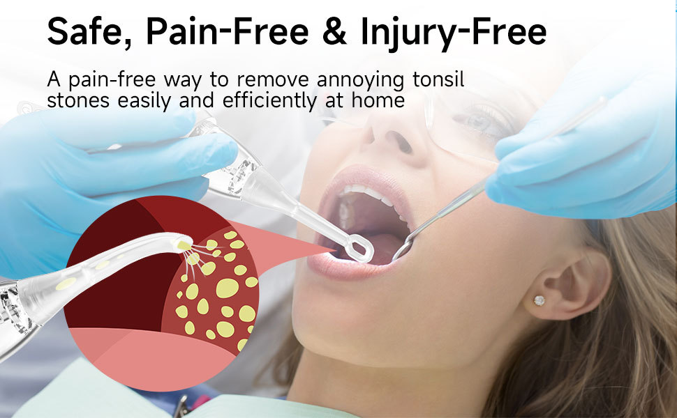Tonsil Stone Vacuum