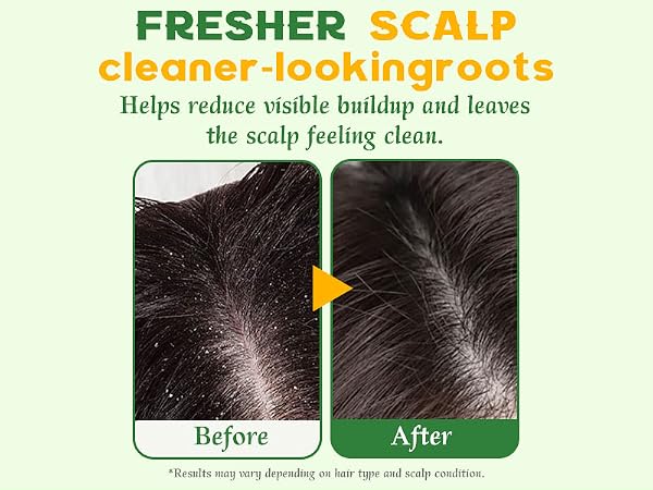 rosemary shampoo bar hair growth Oily Sensitive Itchy Thinning Dandruff Prone Scalp travel size