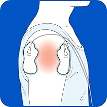 Omron TENS Pads