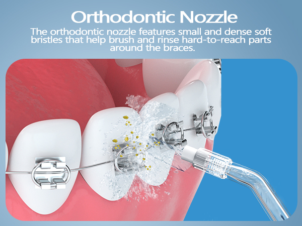 Orthodontic Nozzle