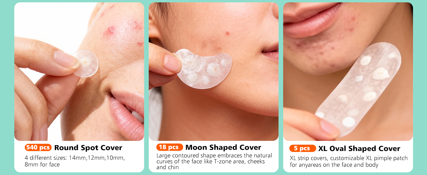pimple patches