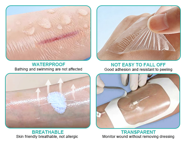 Transparent Film Dressing