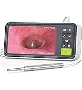 AnyScope 1080P Digital Otoscope with Gyroscope, 3.9mm Ear Scope Camera with 6 Lights, 4.5 Inches ...