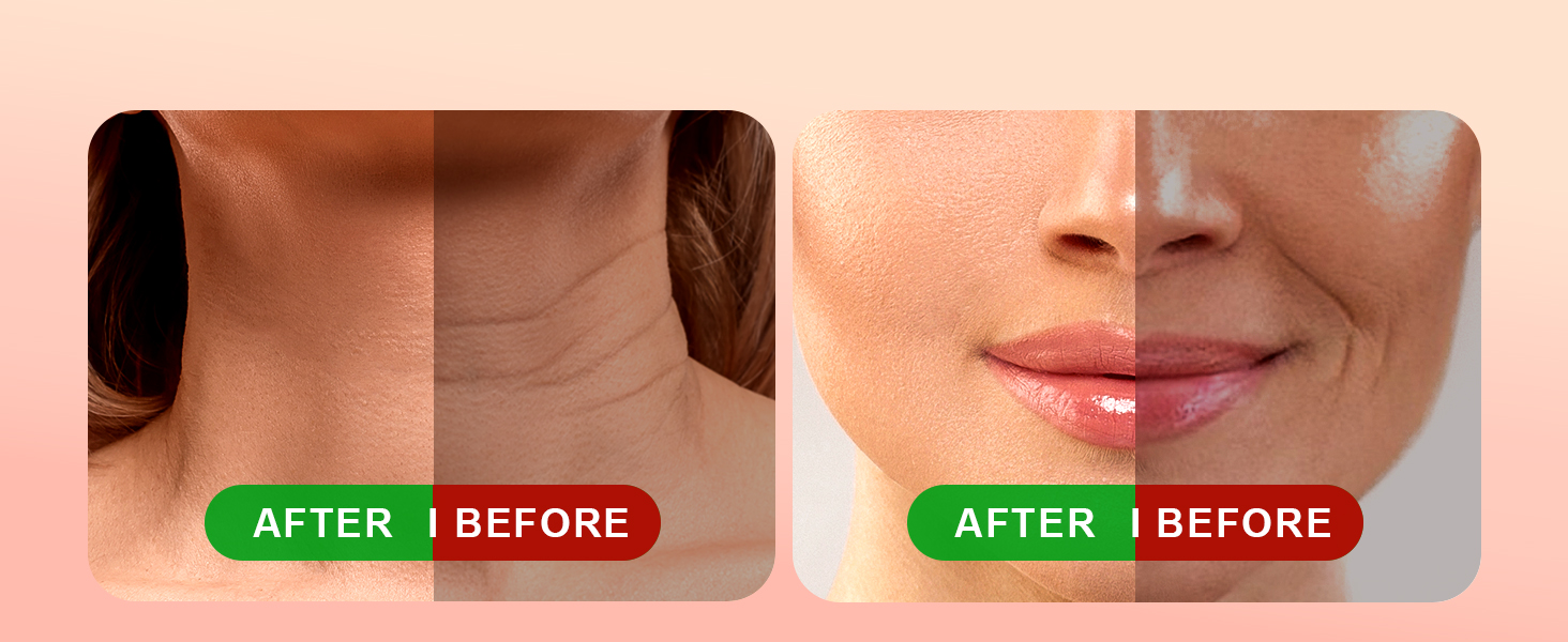 face light therapy device