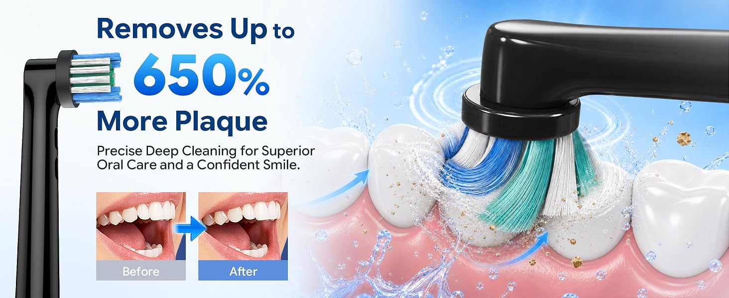 electric toothbrush