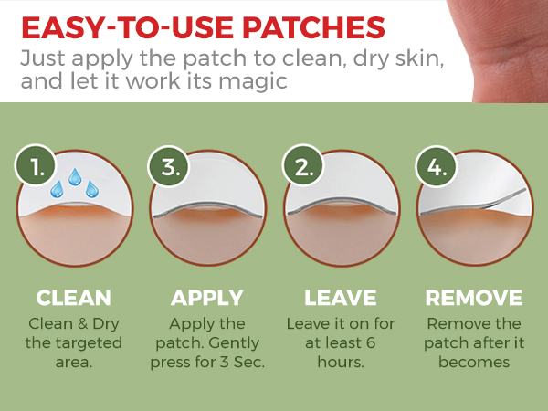 star face pimple patches, zit patches for face, acne patches for face, hydrocolloid pimple patches