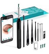 Ear Wax Removal Tool, high-Definition Otoscope, with Ear Collection Tool, 4 Ear Spoons, and 6 LED...