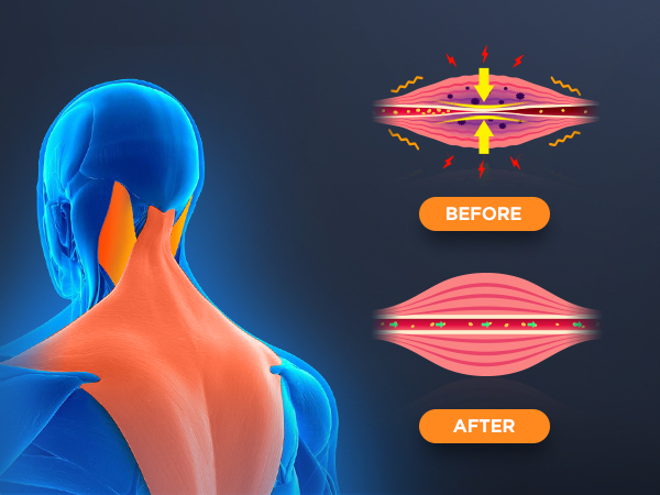 Neck Stretcher