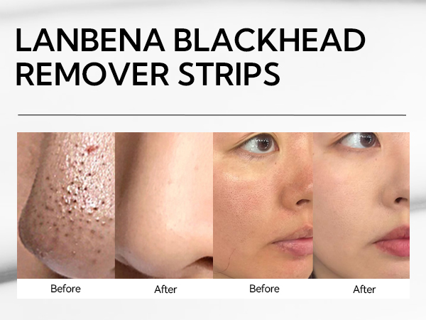 blackhead remover mask; blackhead remover for face; peel off ;lanbena nose plants pore strips