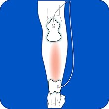 Omron TENS Pads
