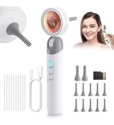 Otoscope Ear Camera with 1.38” IPS Screen, HD Ear Scope with Lights, Otoscope Camera for Adults K...