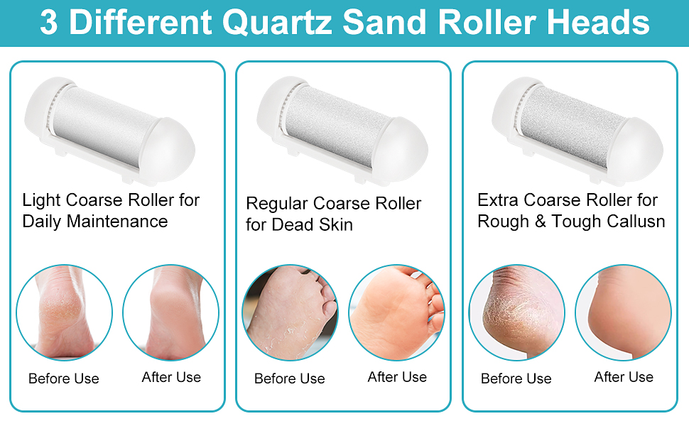 electric callous removers 