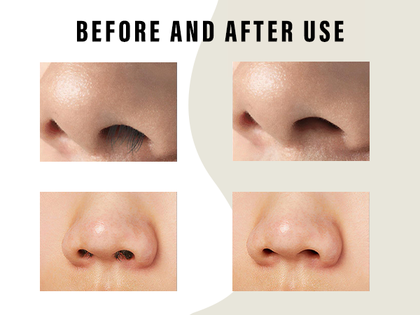 nose hair remover