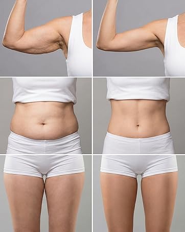 Body Sculpting Machine