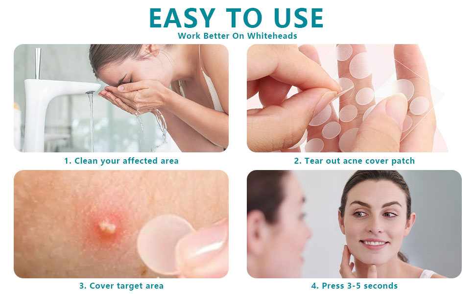 Pimple Patch