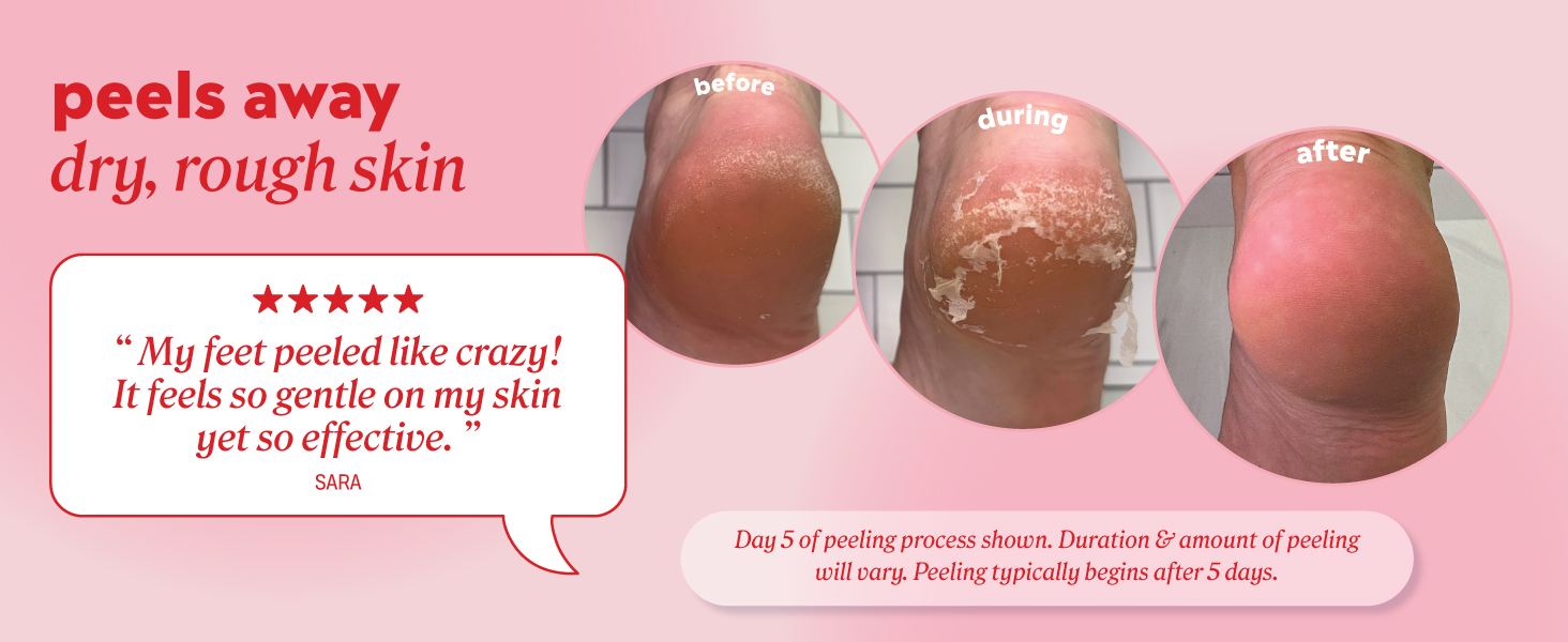 Customer review: My feet peeled like crazy! It feels so gentle on my skin yet so effective&amp;#34;