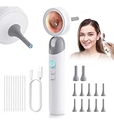 Aertnelz 1080P HD Otoscope Ear Camera for Family &amp; Pets, Medical Grade 1.38" Screen, Telemedicine...