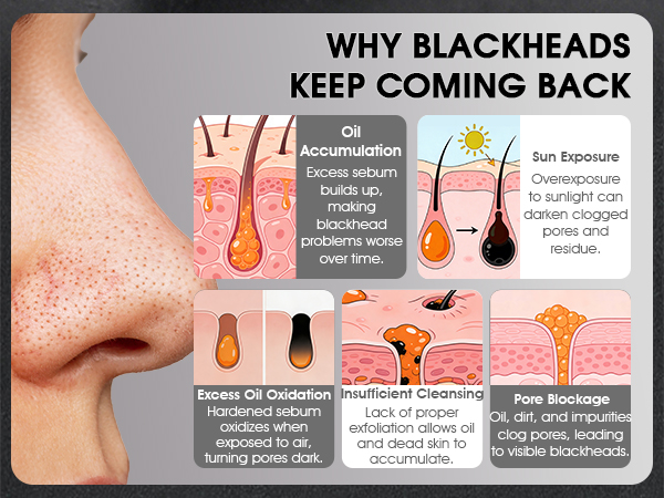 Blackhead Remover Mask Kit