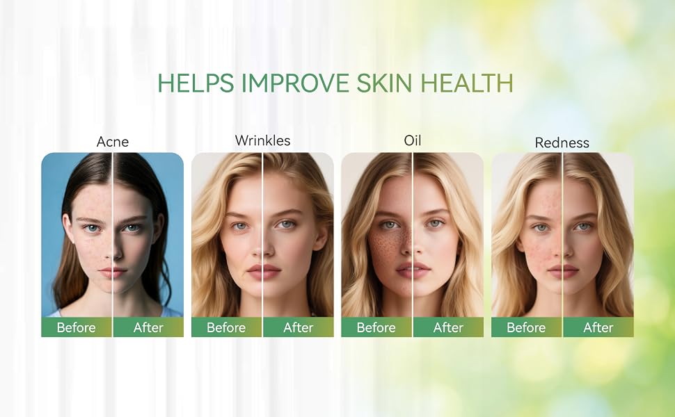 evertone led face and neck mask