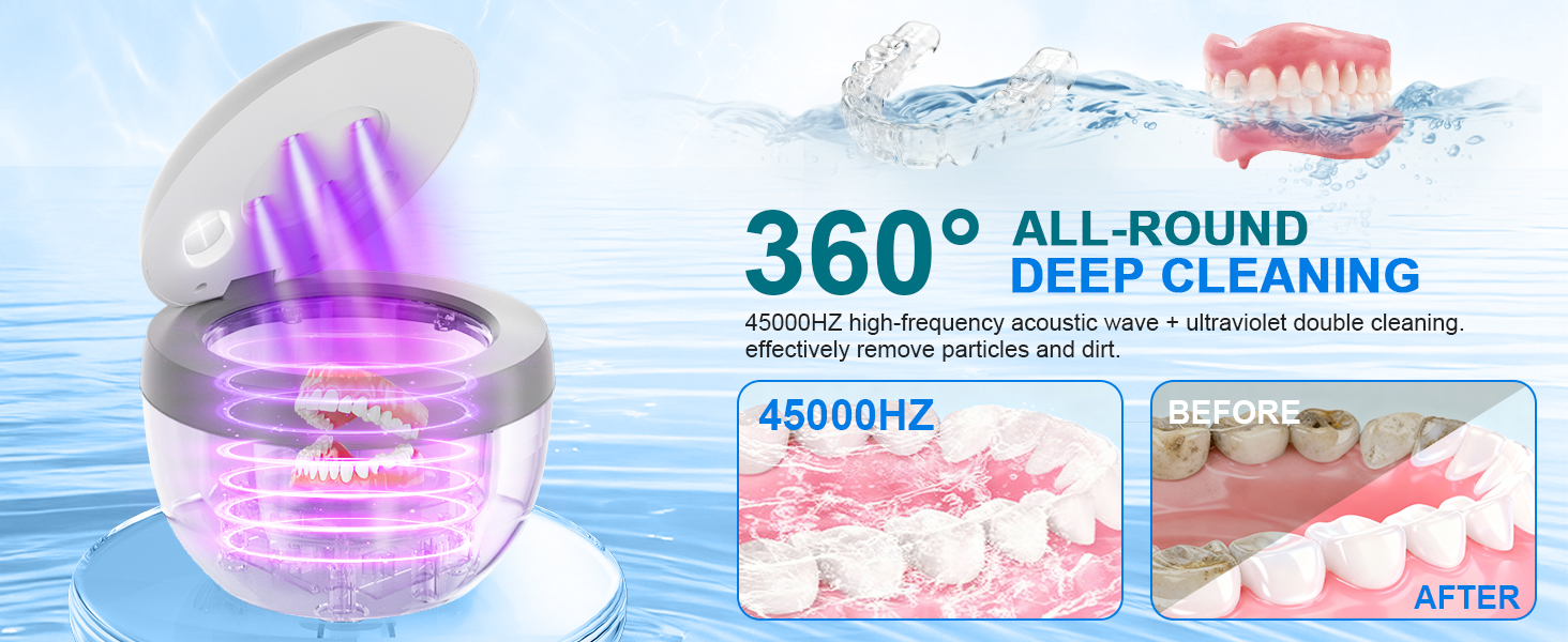 ultrasonic retainer cleaner