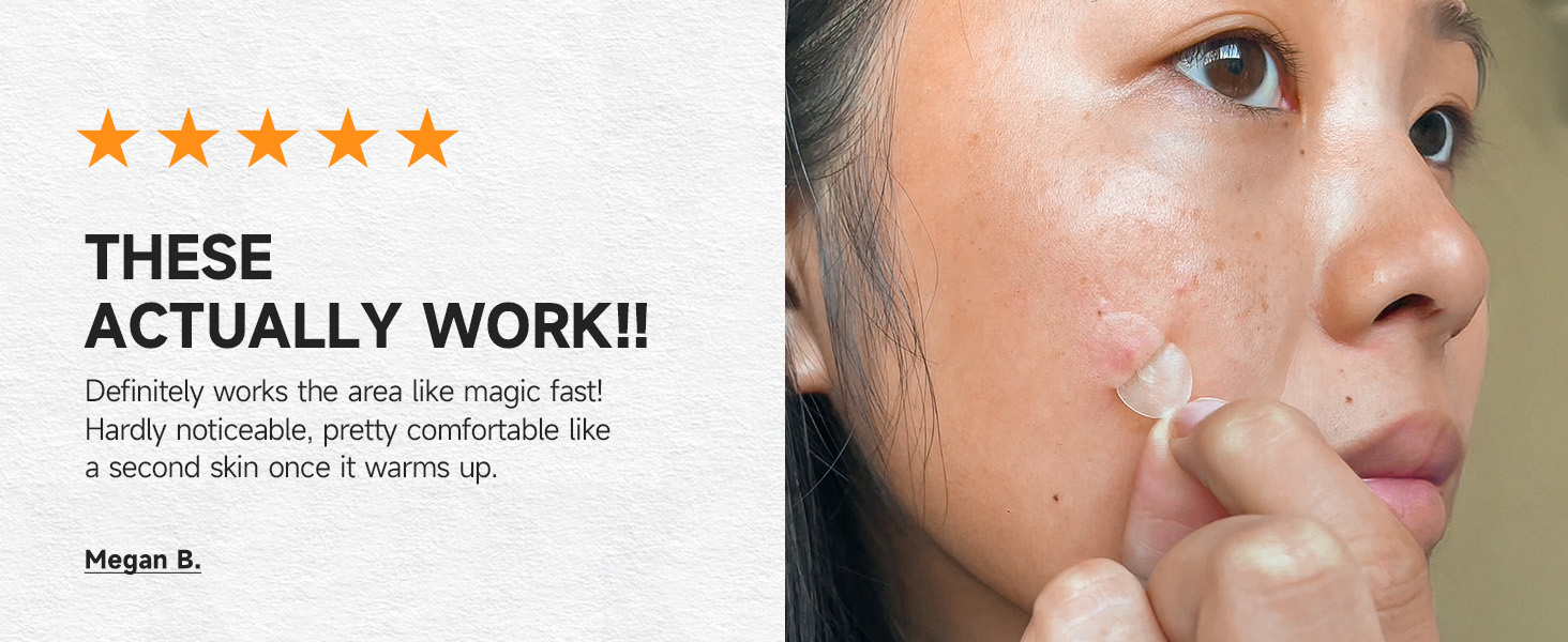 pimple patches