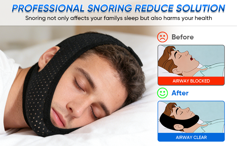 PROFESSIONAL SNORING REDUCE SOLUTION
