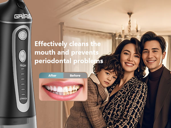 water flosser