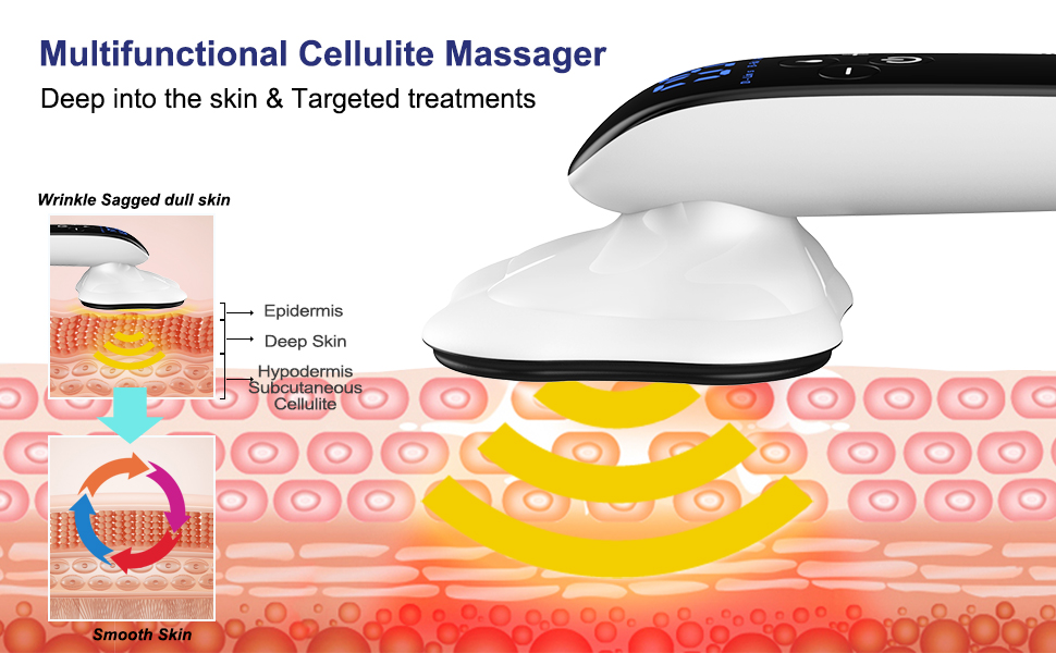 multifunctional cellulite massager 