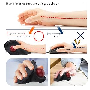 Hand in ?natural resting position