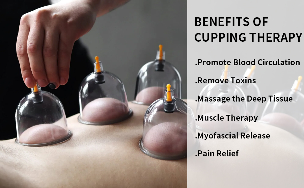 Chinese cupping set