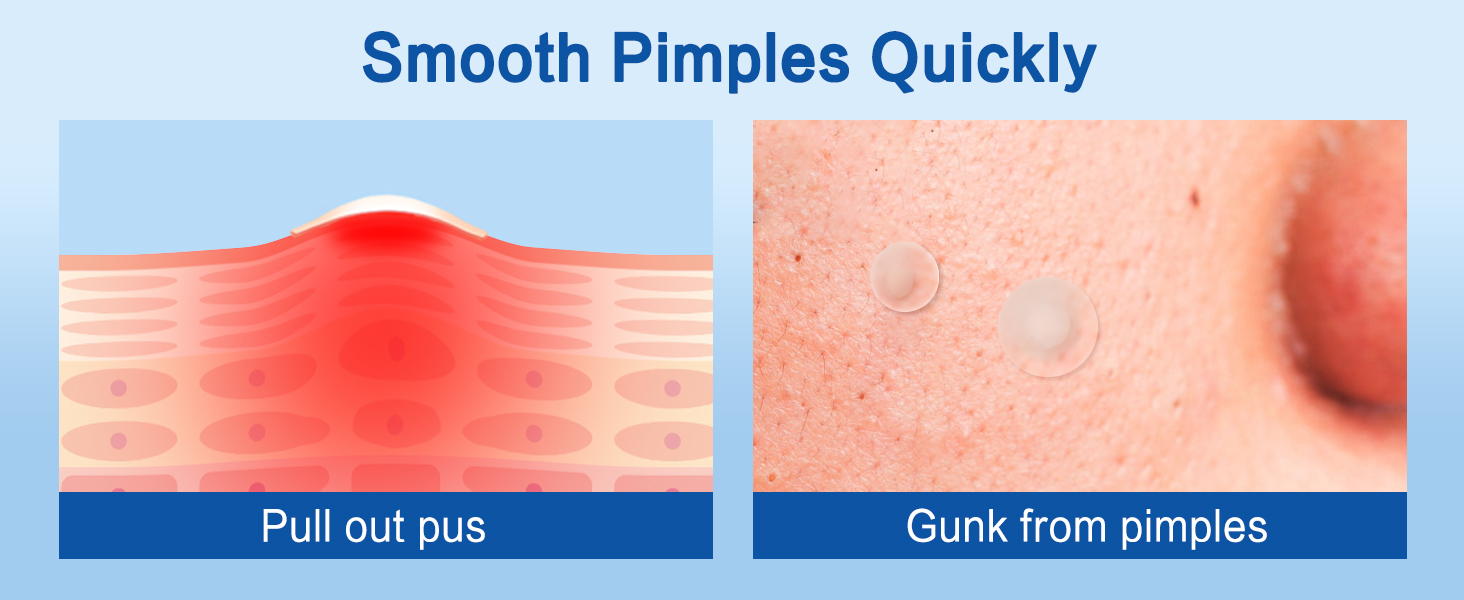 Pimple Patches for Face
