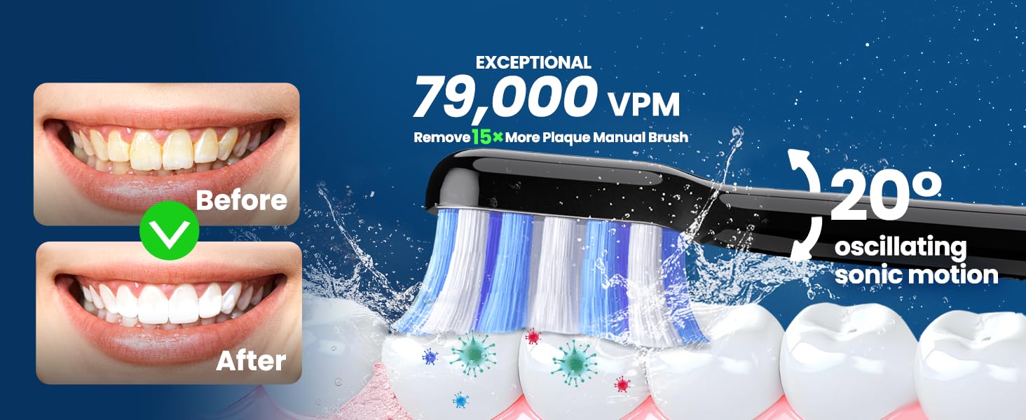 Marlincare electric toothbrush