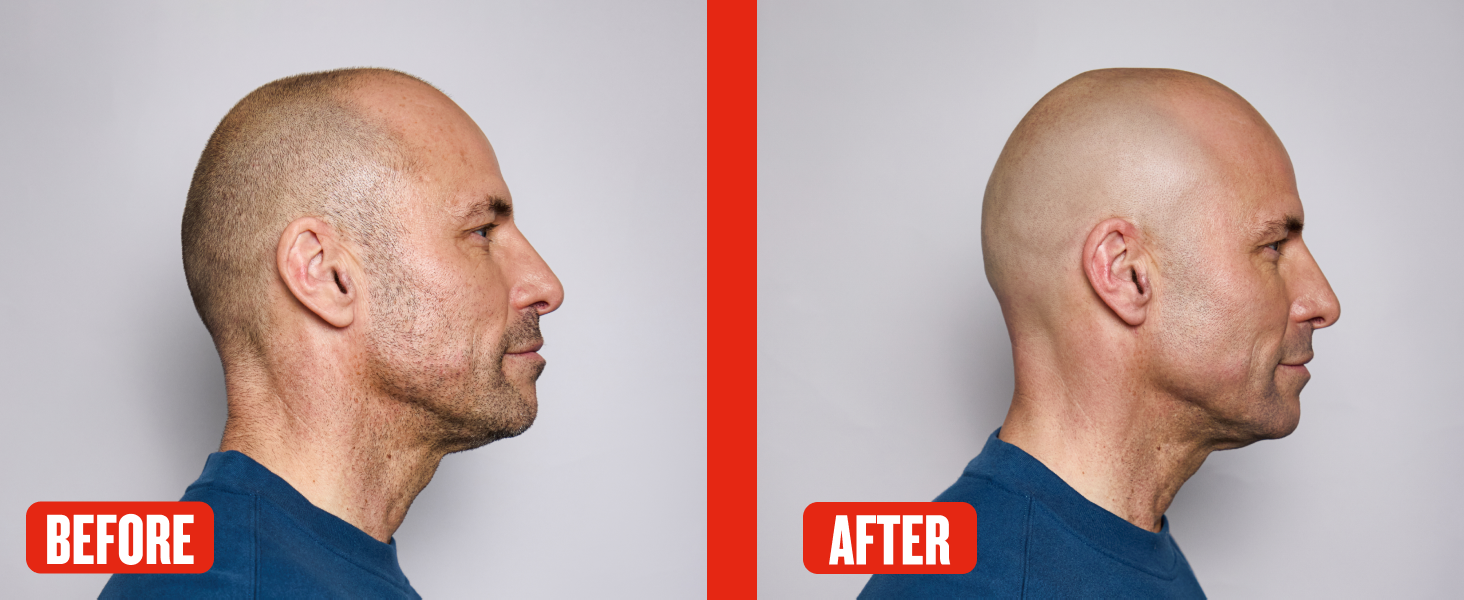 Electric head and beard shaver with constant skin contact for a close comfortable shave