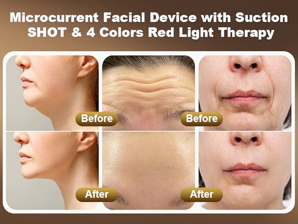 face red light therapy