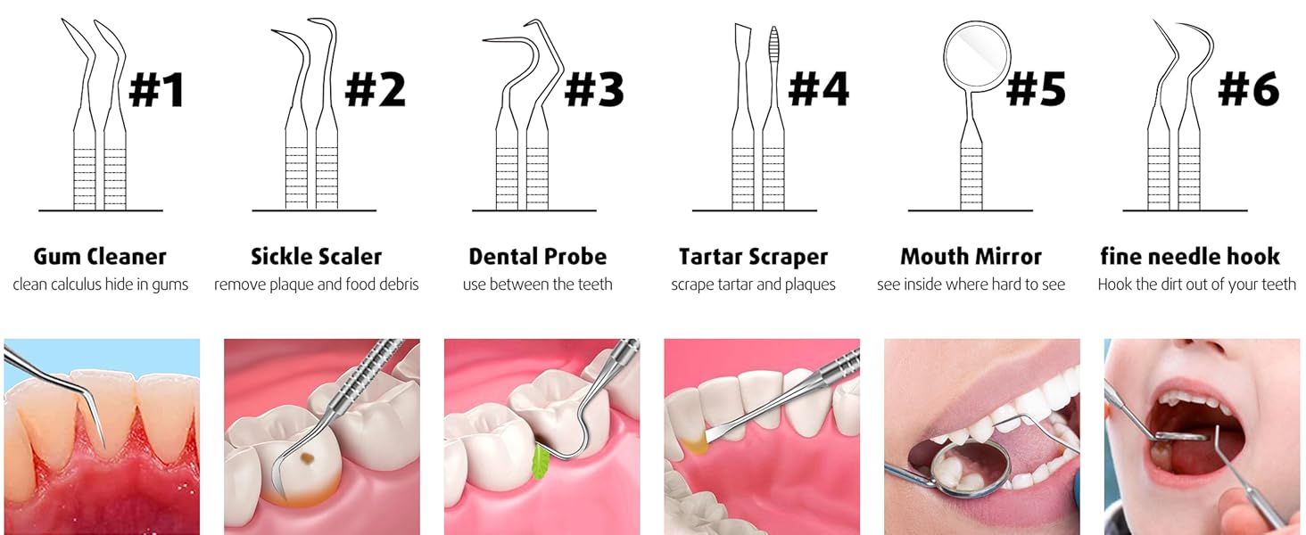 plaque remover for teeth