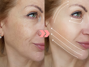 face sculpting device