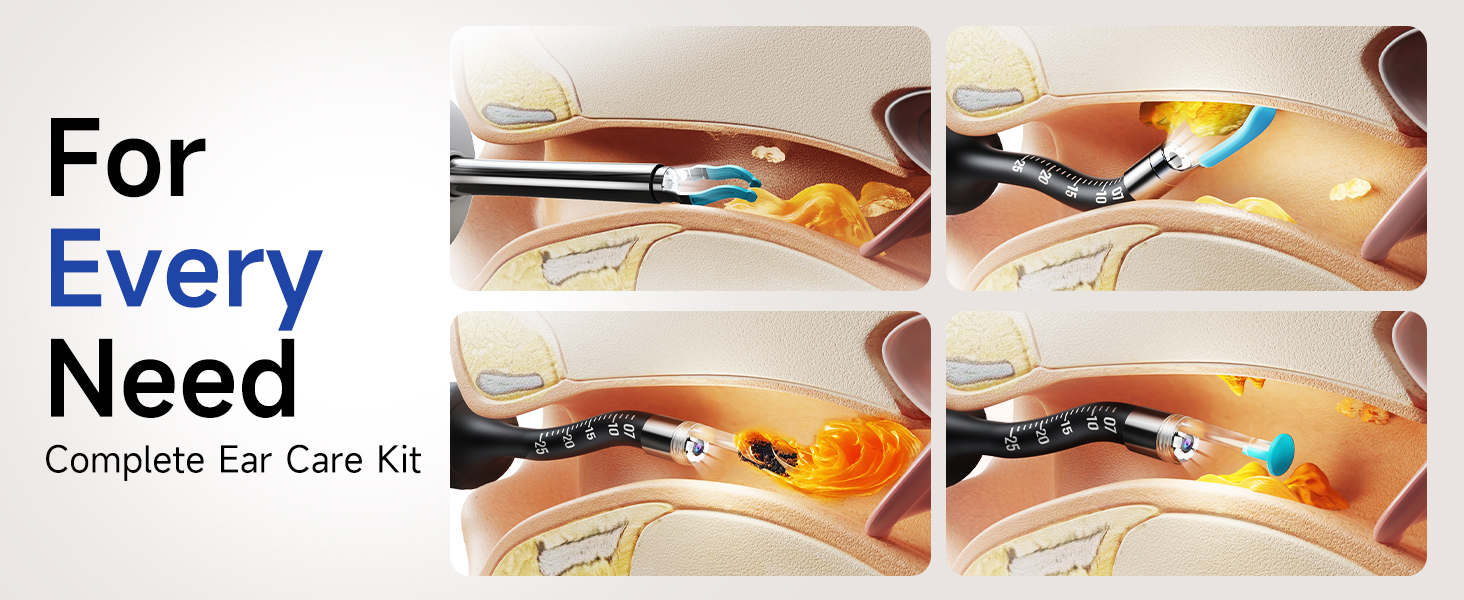 Ear Wax Removal Tool Camera