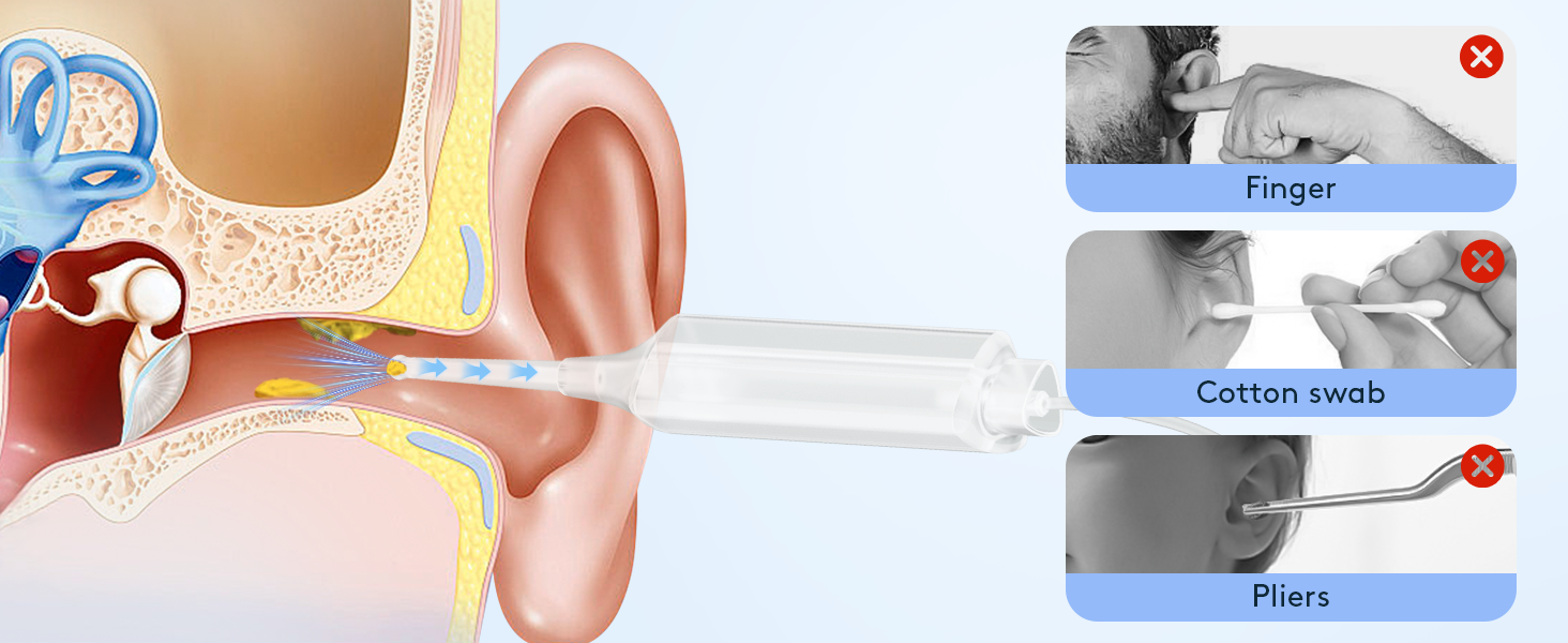 Ear Wax Vacuum