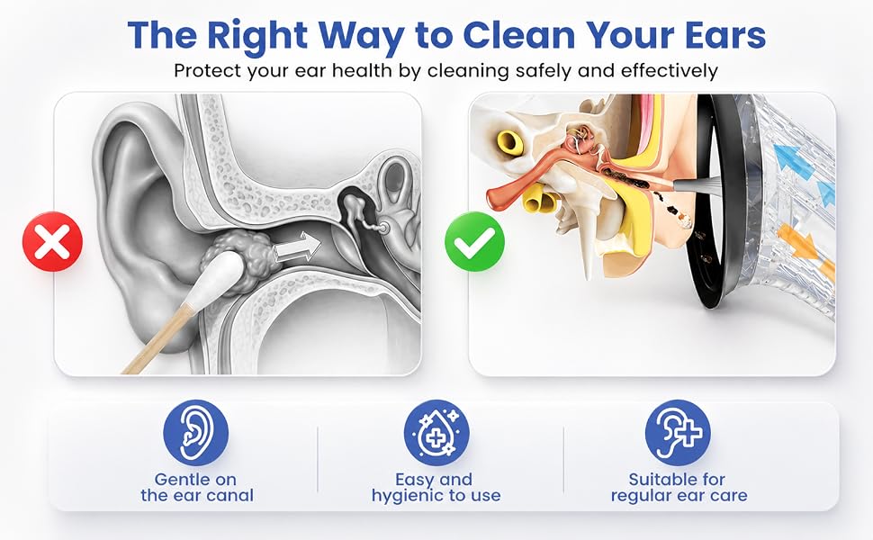 ear wax removal tool, ear wax removal kit
